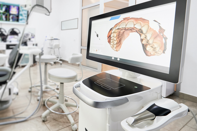 Intra-Oral Scanner in Garden Grove